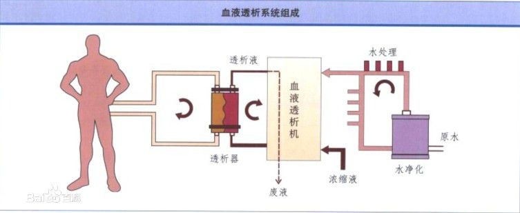 血液透析系統(tǒng)組成